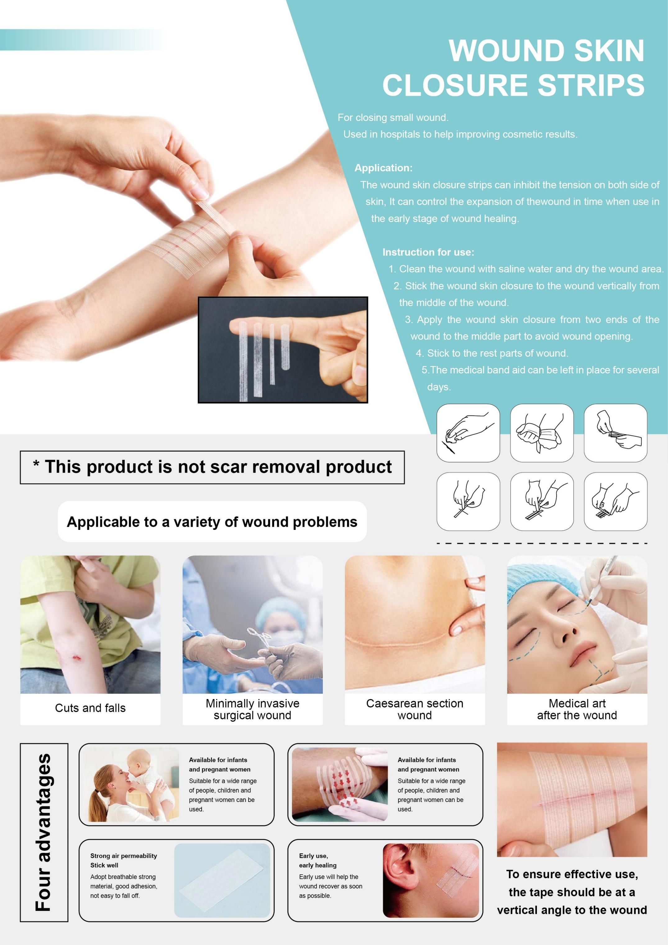 Wound Skin Closure Strips
