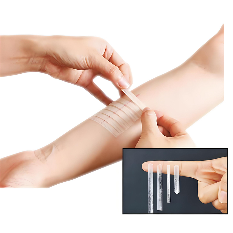 Wound Skin Closure Strips